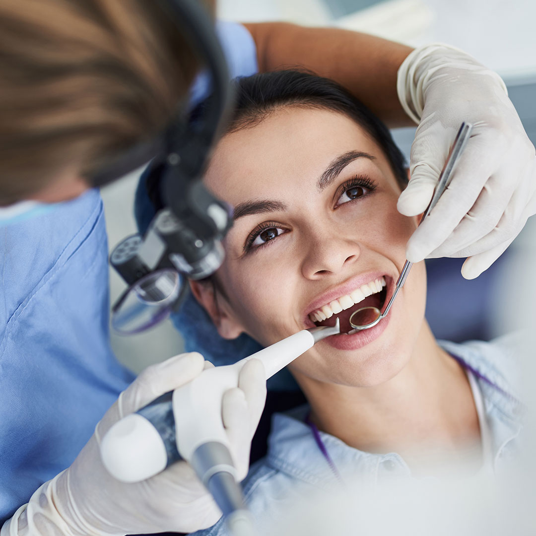 askew-dental-composite-bonding