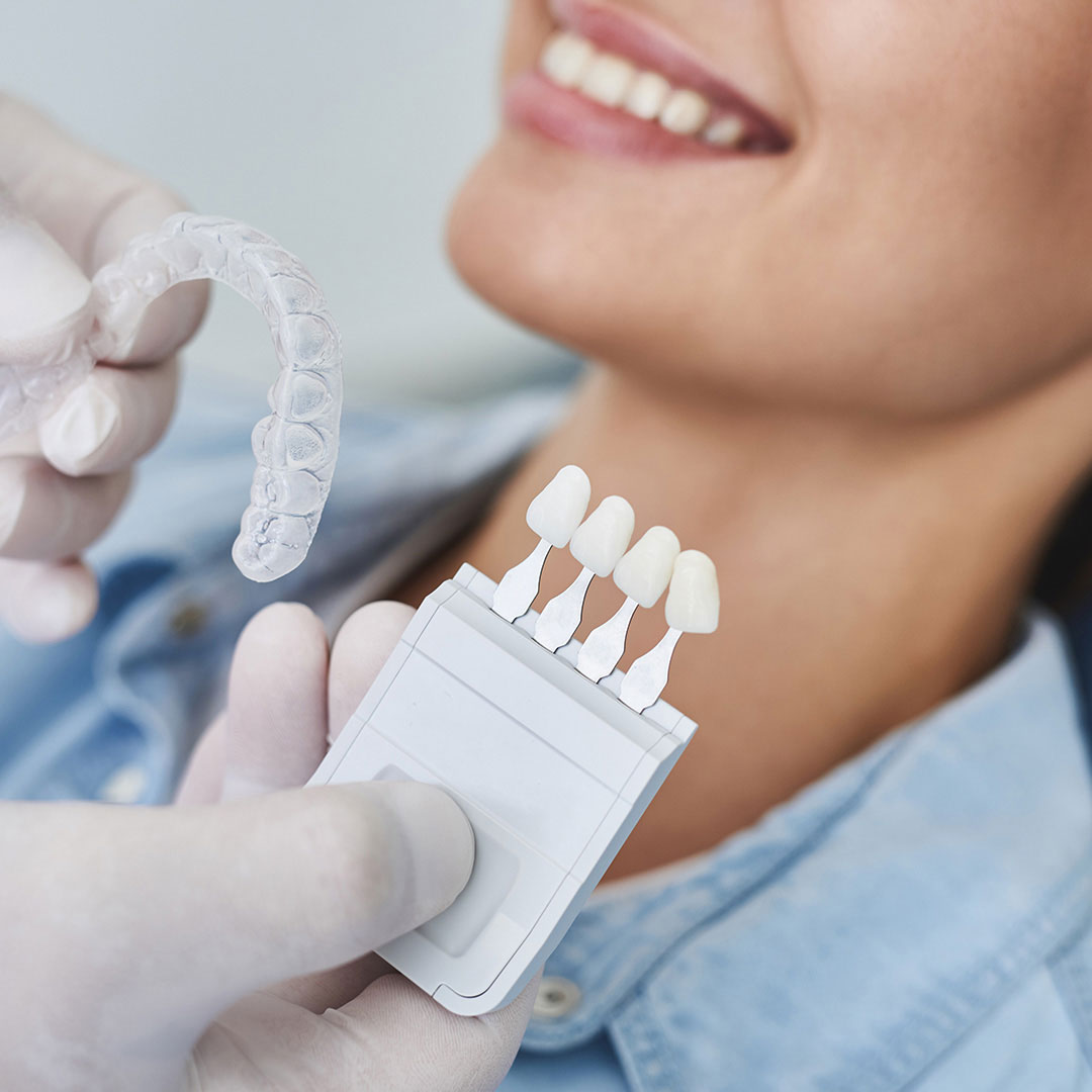 askew-dental-invisalign-aligner