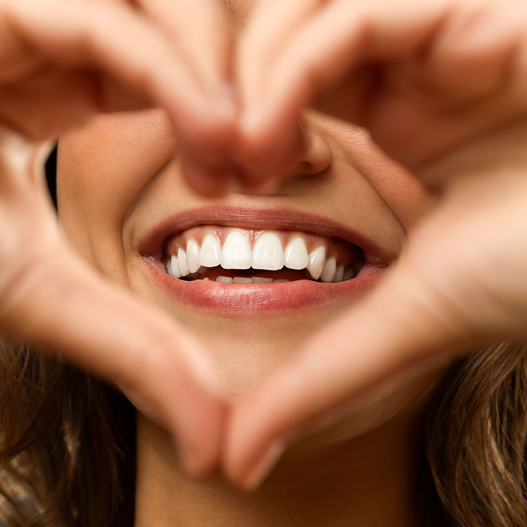 askew-dental-veeners-benefits